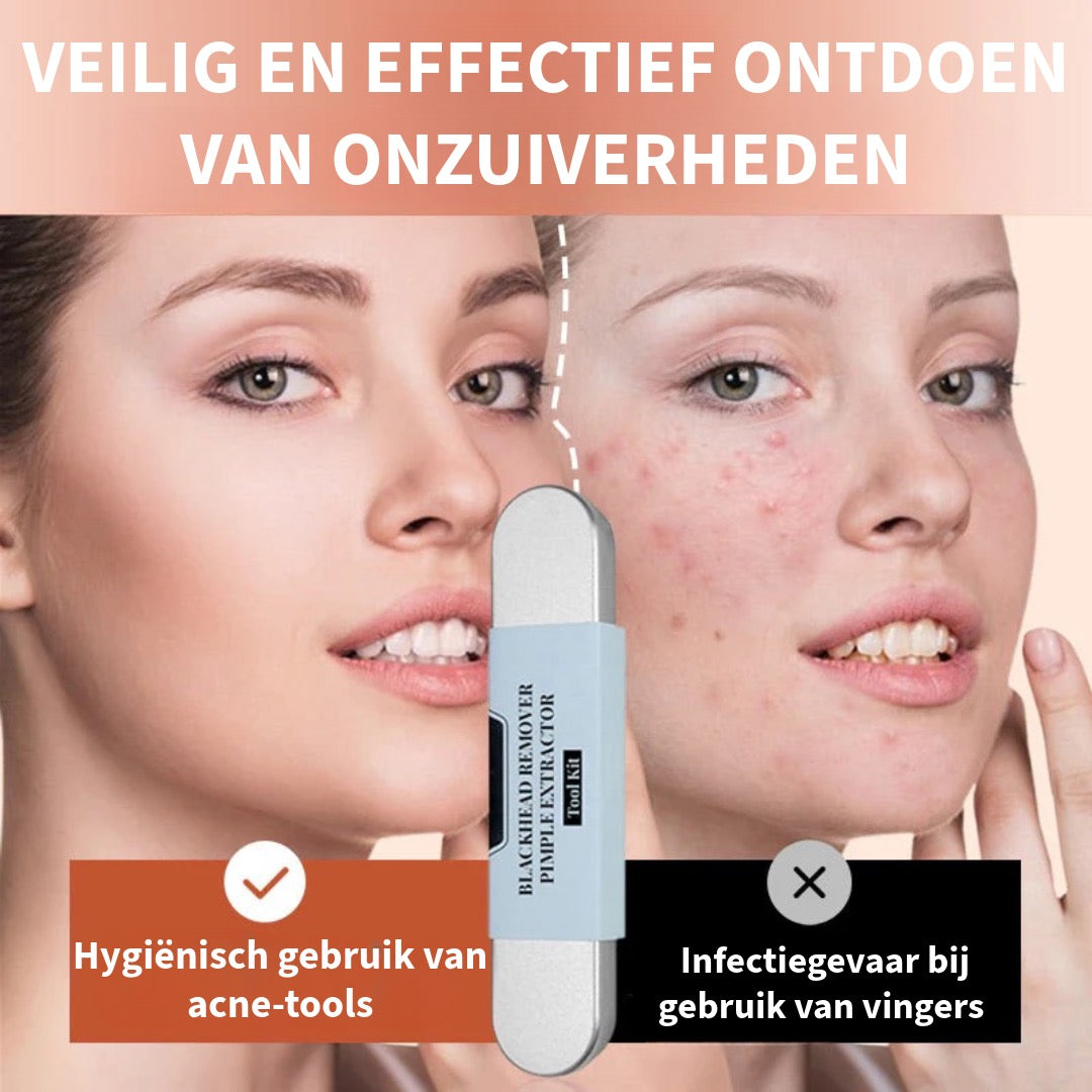Roestvaststalen Verwijderingsset voor Mee-Eters