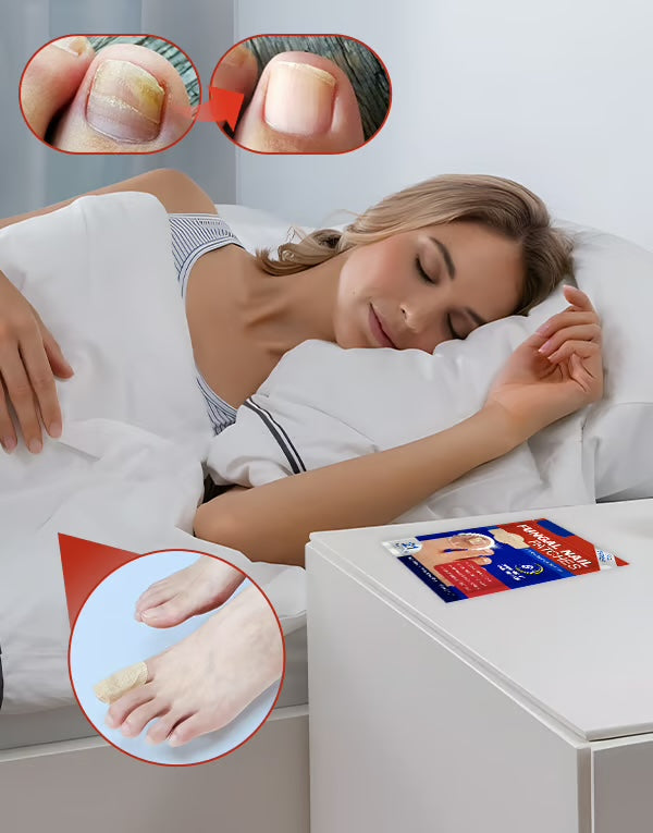 Anti-Schimmel Nagel Plakkers