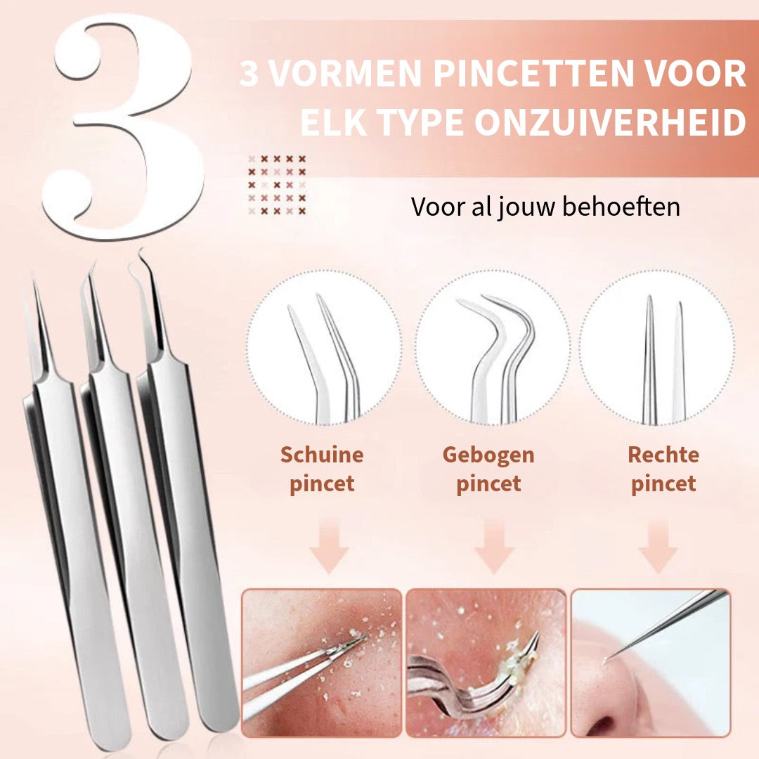 Roestvaststalen Verwijderingsset voor Mee-Eters
