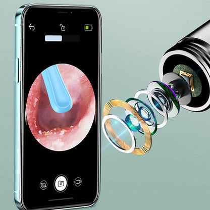 Gevisualiseerde Elektrische Oorsmeerverwijderaar